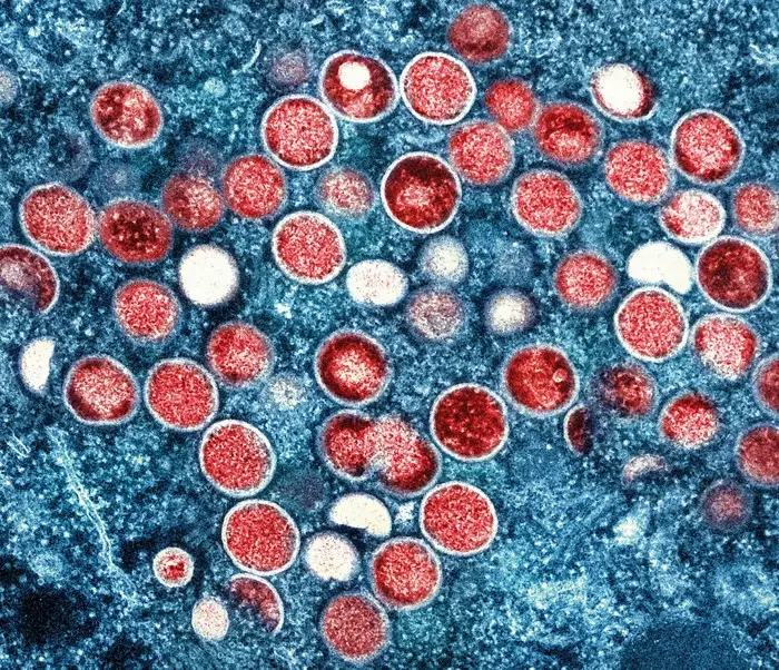 20240816lnp2-mpox-1